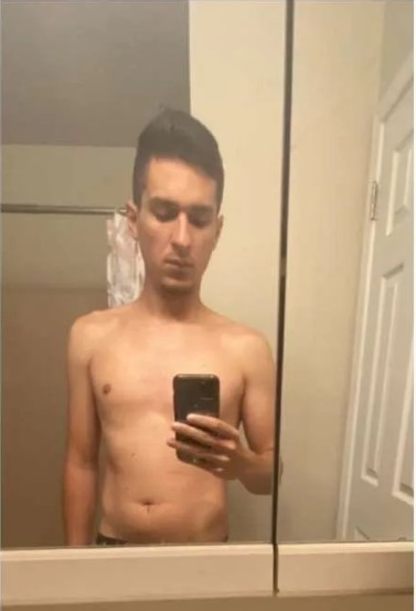 Before image of weight loss transformation