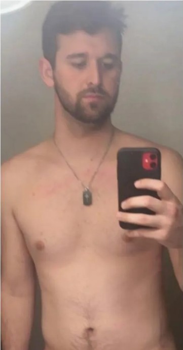 Before image of weight loss transformation